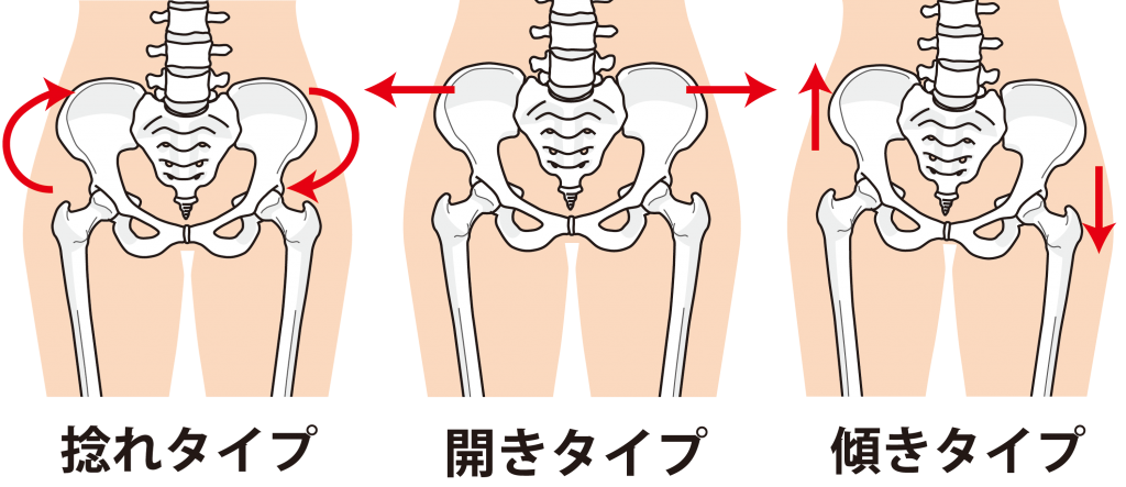 バレエで骨盤を整え歪みのない身体へ 歪みの原因と改善方法